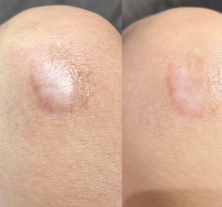 DermaFit™
