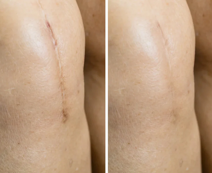 DermaFit™